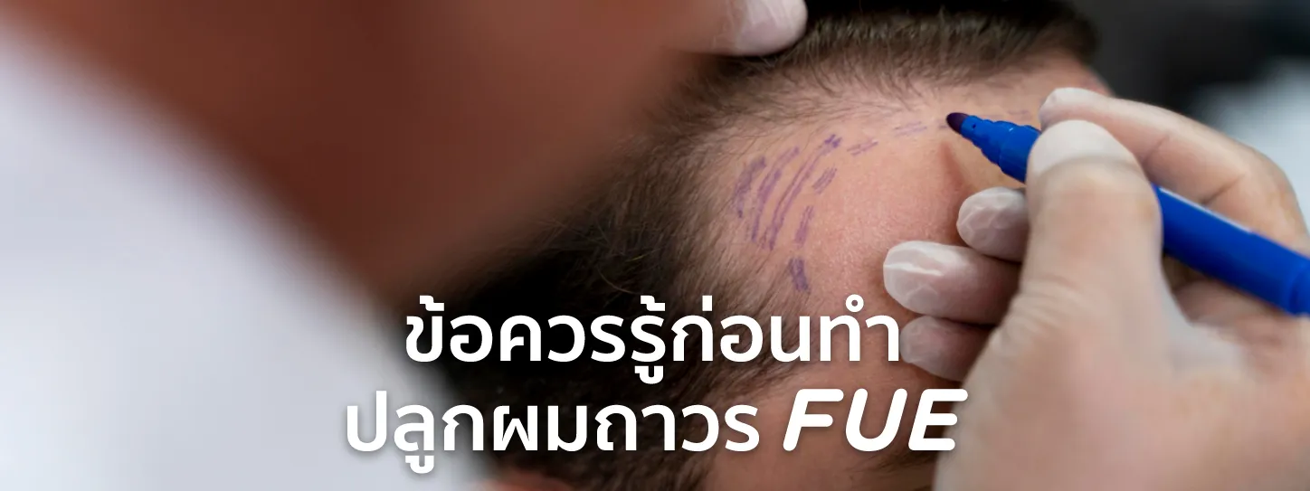ปลูกผม