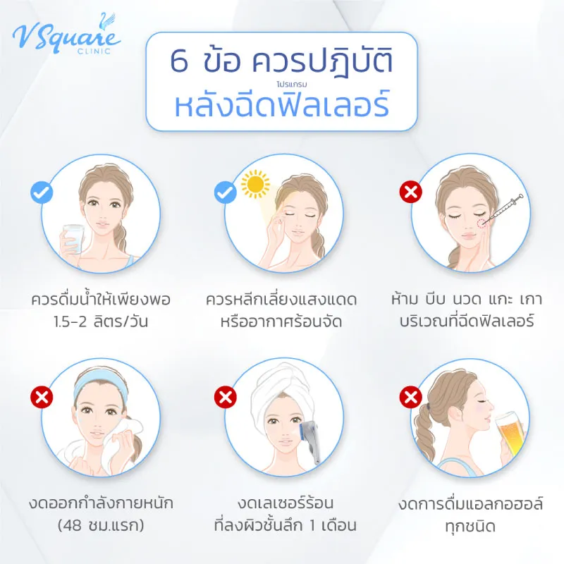 หลังฉีดฟิลเลอร์ร่องแก้ม