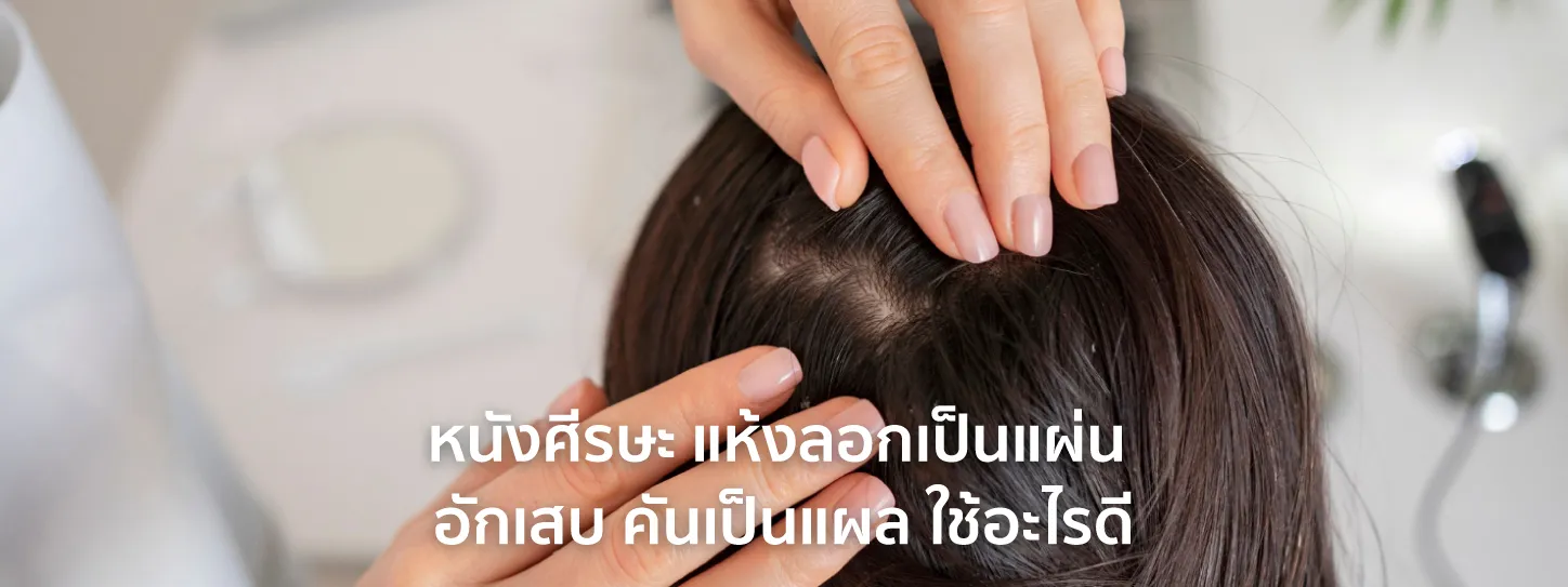 หนังศีรษะ แห้งลอก