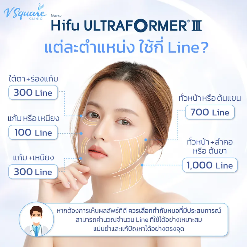 ตำแหน่งทำ Hifu