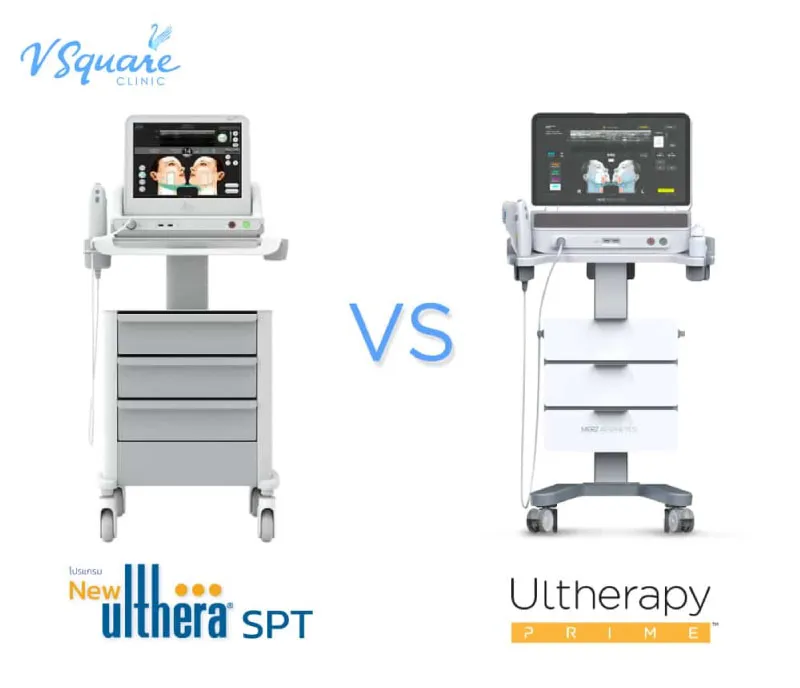 Ulthera Prime VS SPT 