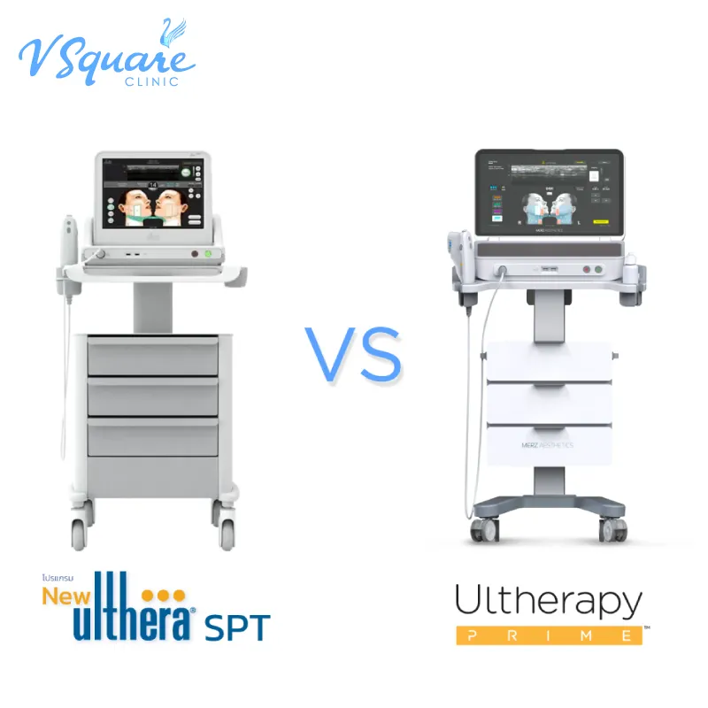 Ulthera SPT vs Ulthera Prime