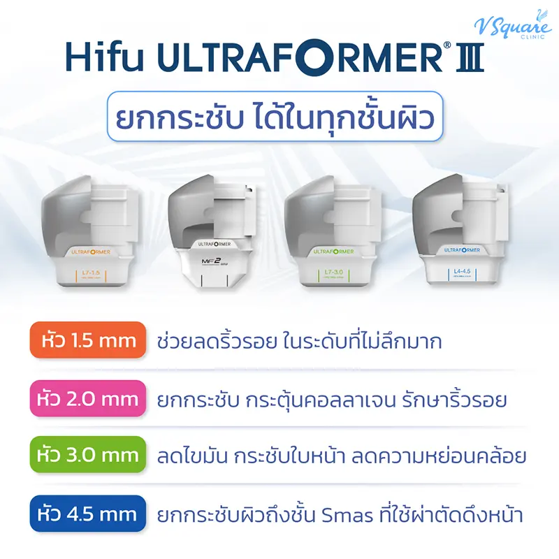 Ultraformer III หัวยิง