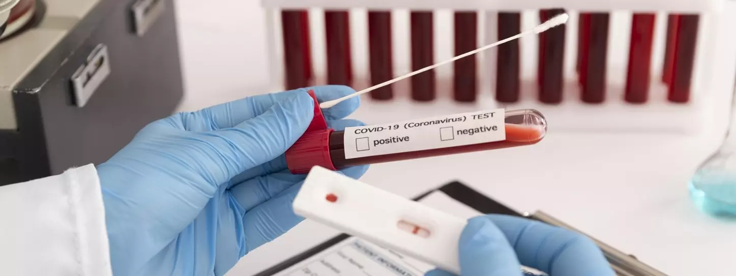ตรวจหาเชื้อไวรัสโควิด-19 ด้วยวิธี Rapid Antibody Test
