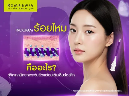 ไหม Epiticon คืออะไร ไหม Epiticon คืออะไร