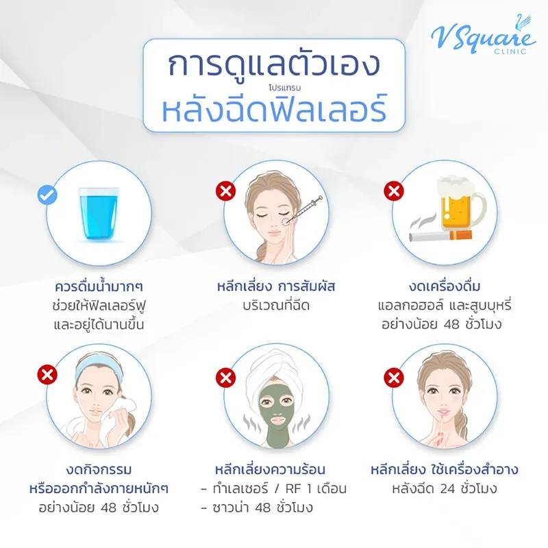Definisse Filler ฟิลเลอร์อิตาลี จุดเด่น ตำแหน่งฉีด และราคา