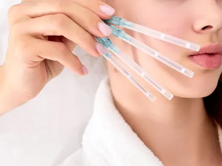 ร้อยไหม เทคนิคยกกระชับ หน้าเรียวสวยทันใจ ร้อยไหม เทคนิคยกกระชับ หน้าเรียวสวยทันใจ