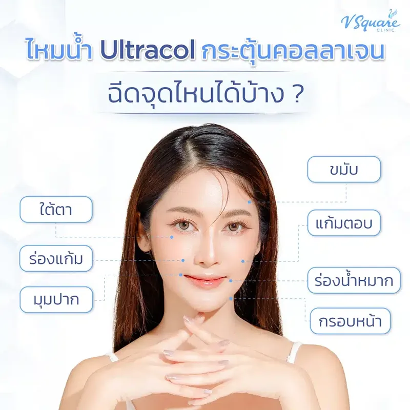 Ultracol สารกระตุ้นคอลลาเจน ฟื้นฟูผิวแน่น ยกกระชับ คืนความอ่อนเยาว์ 