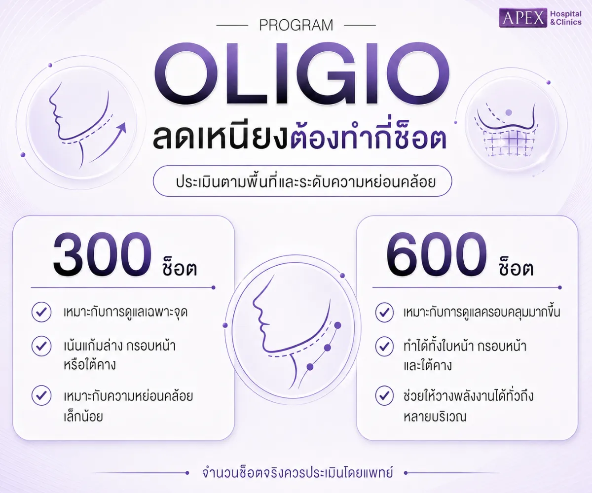 Oligio ลดเหนียงได้ไหม ต้องทำกี่ช็อตจึงจะช่วยให้เหนียงลด 