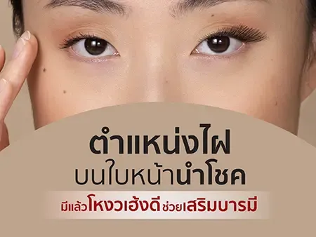 ไฝนำโชค