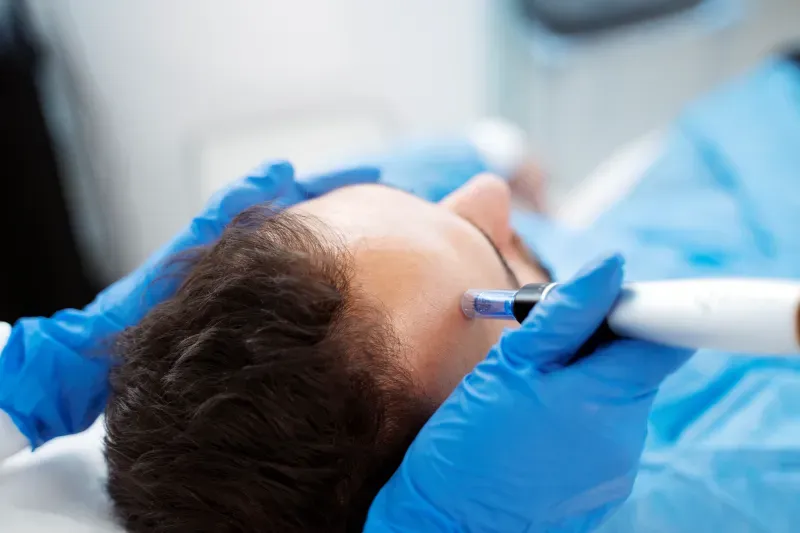 ปลูกผม ปลูกผม