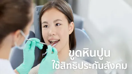 ขูดหินปูน ประกันสังคม