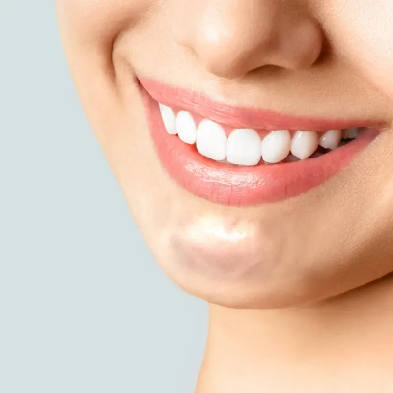 ฉีดสลายฟิลเลอร์คาง