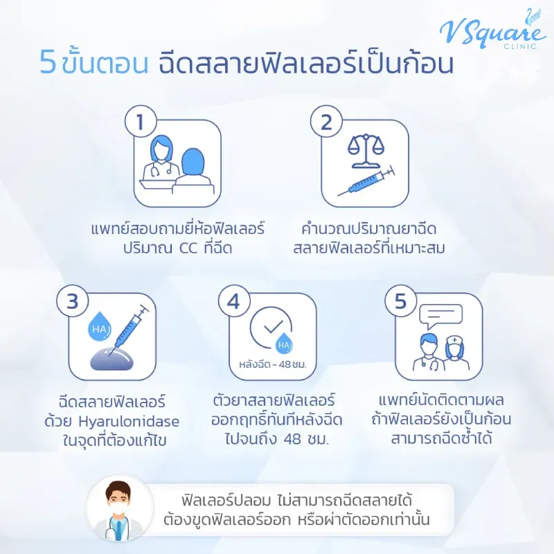 ขั้นตอนการฉีดสลายฟิลเลอร์