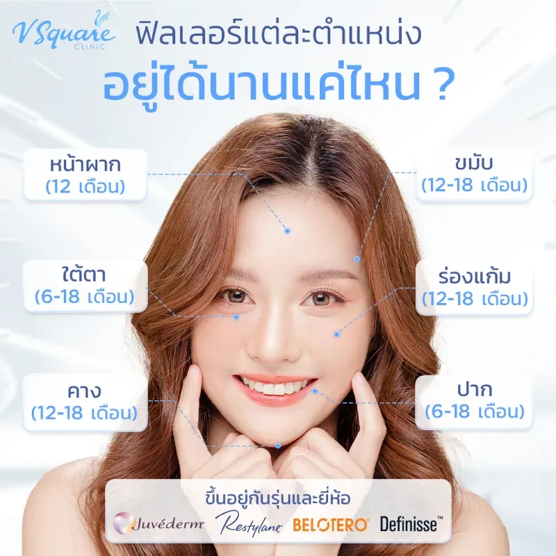 ฉีดฟิลเลอร์อยู่ได้นานแค่ไหน