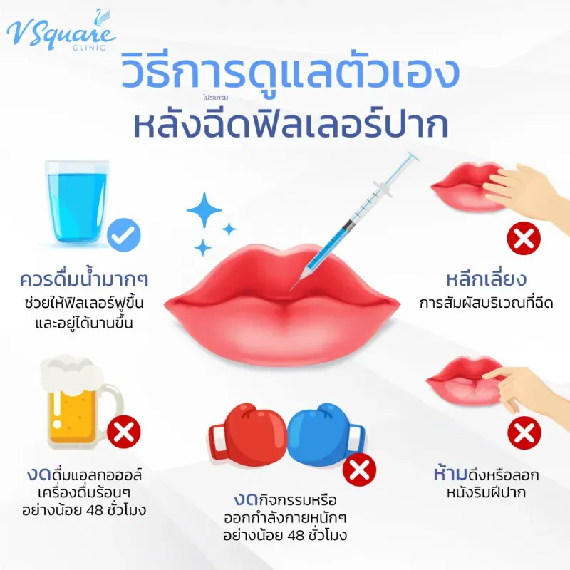 ดูแลตัวเองหลังฉีดฟิลเลอร์ปาก