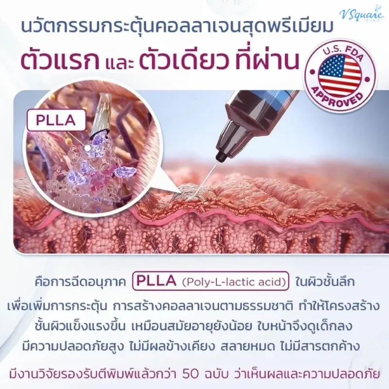 Sculptra Body อันตรายไหม