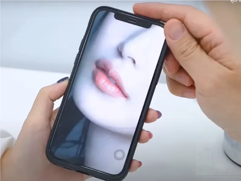 ฉีดฟิลเลอร์ปากราคาแต่ละทรง ฉีดฟิลเลอร์ปากราคาแต่ละทรง