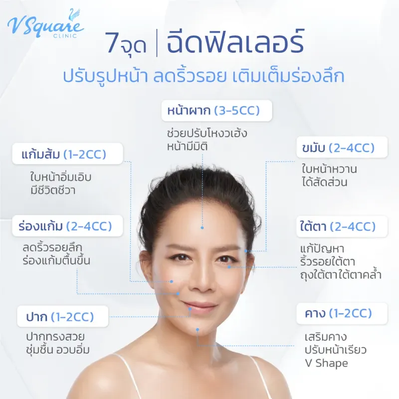 จุดที่นิยมฉีดฟิลเลอร์