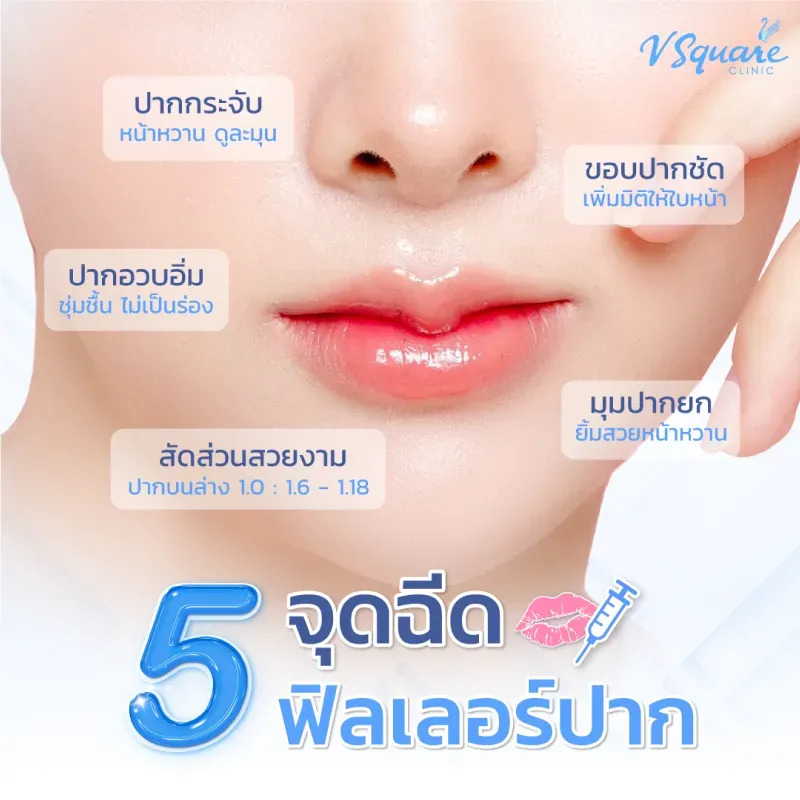 จุดฉีดฟิลเลอร์ปาก