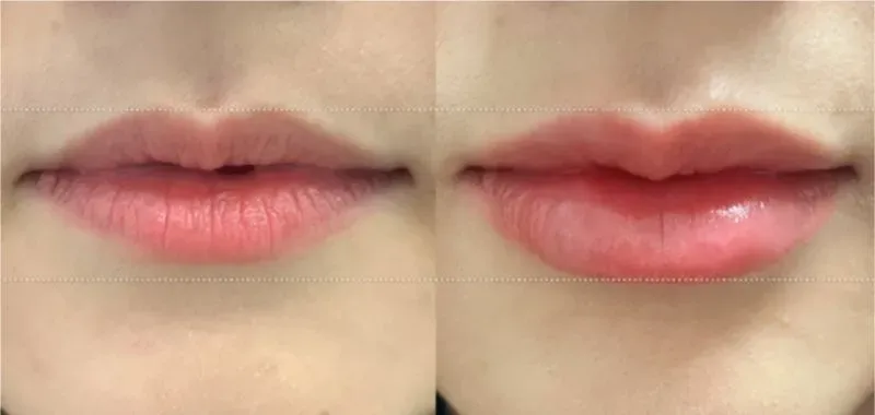 รีวิวทำปากกระจับ