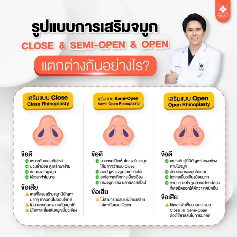 เสริมจมูก