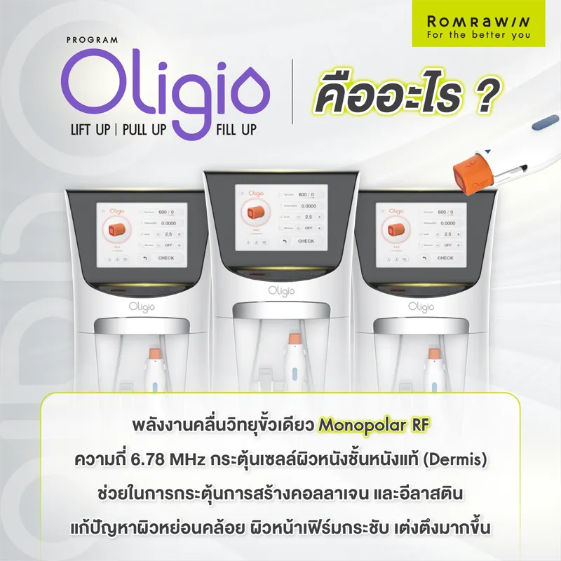 Oligio ยกกระชับใบหน้า