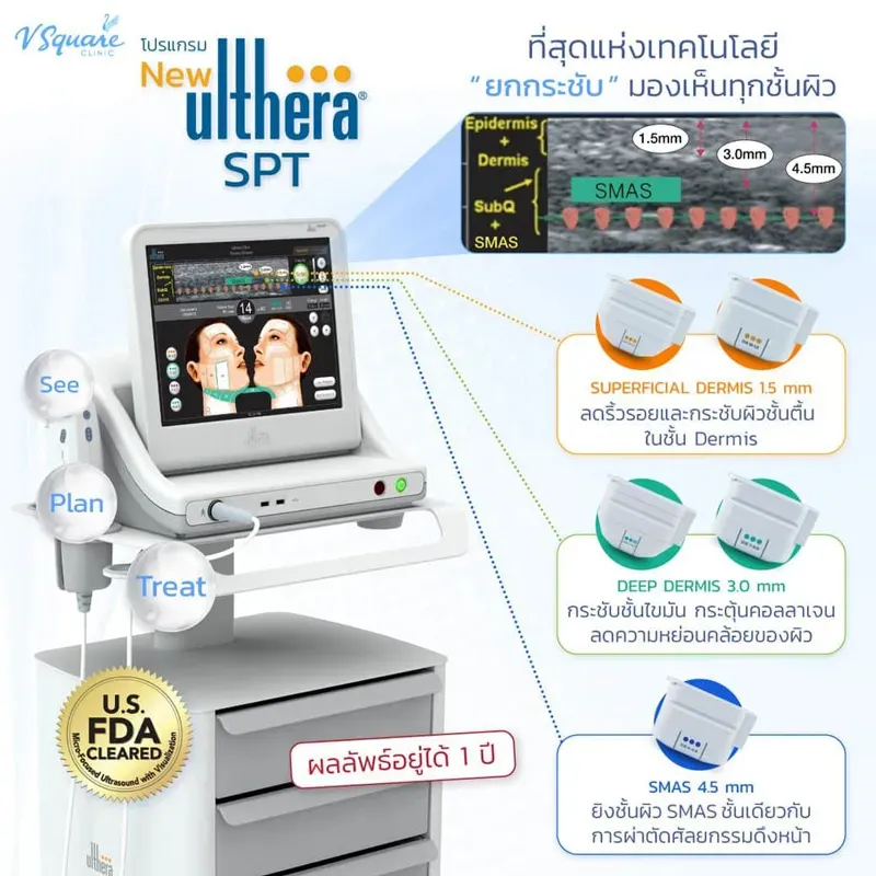 หัวยิงของเครื่อง Ulthera