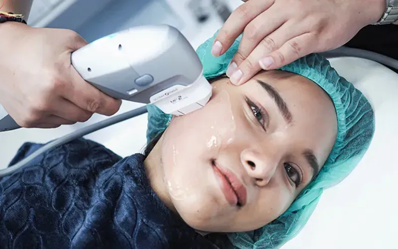 Hifu ยกกระชับหน้า