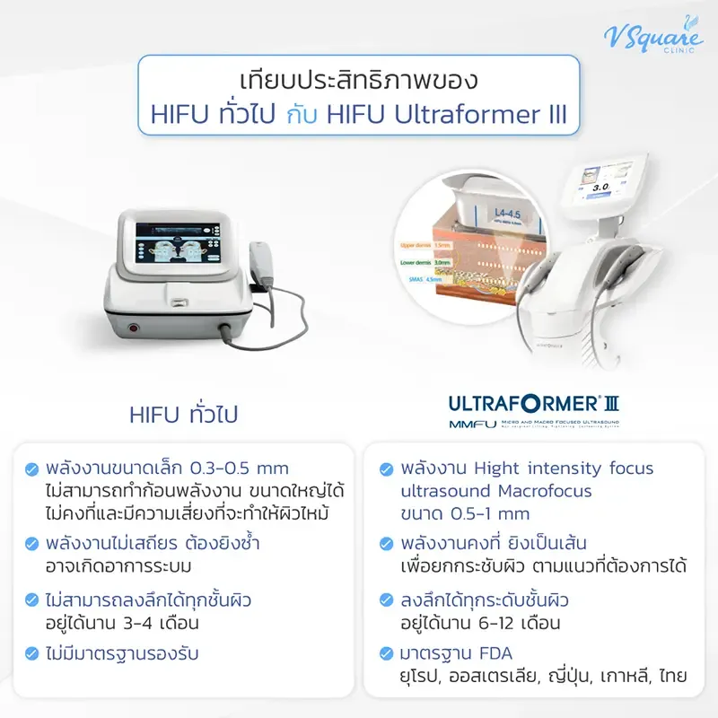 Ultraformer III ต่างจาก Hifu อย่างไร Ultraformer III ต่างจาก Hifu อย่างไร