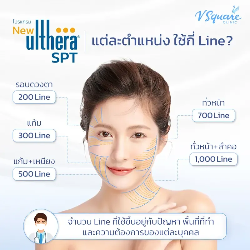 Ulthera ใช้กี่ไลน์ Ulthera ใช้กี่ไลน์