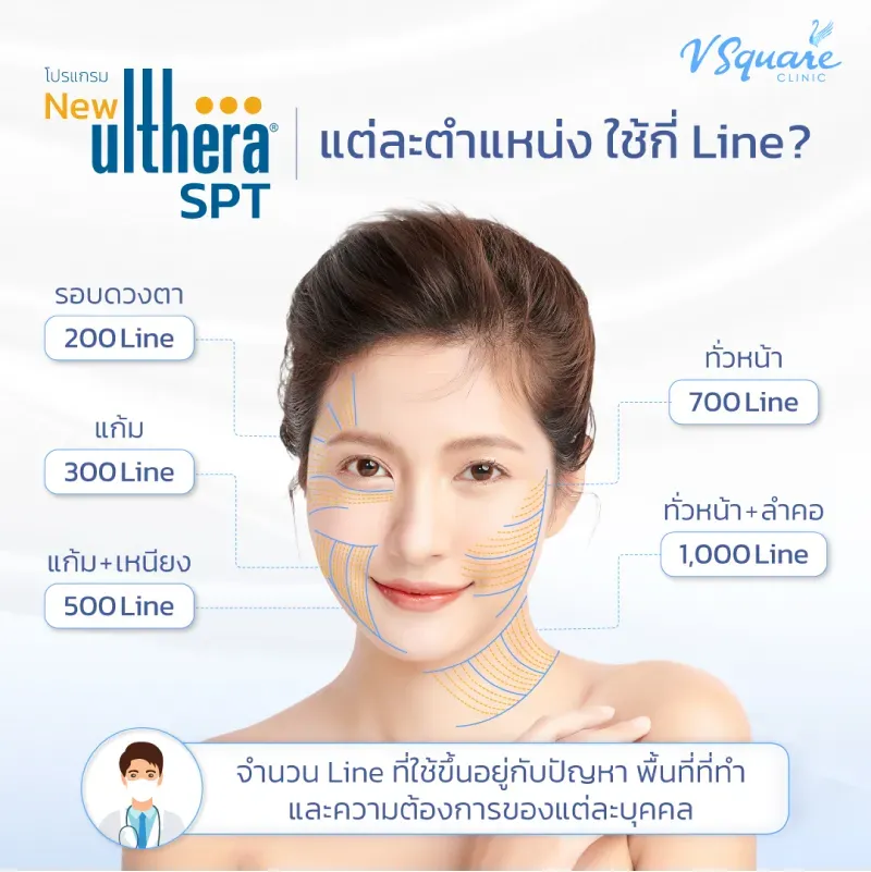 ไลน์ยิงคำนวน Ulthera ราคาแต่ละครั้ง