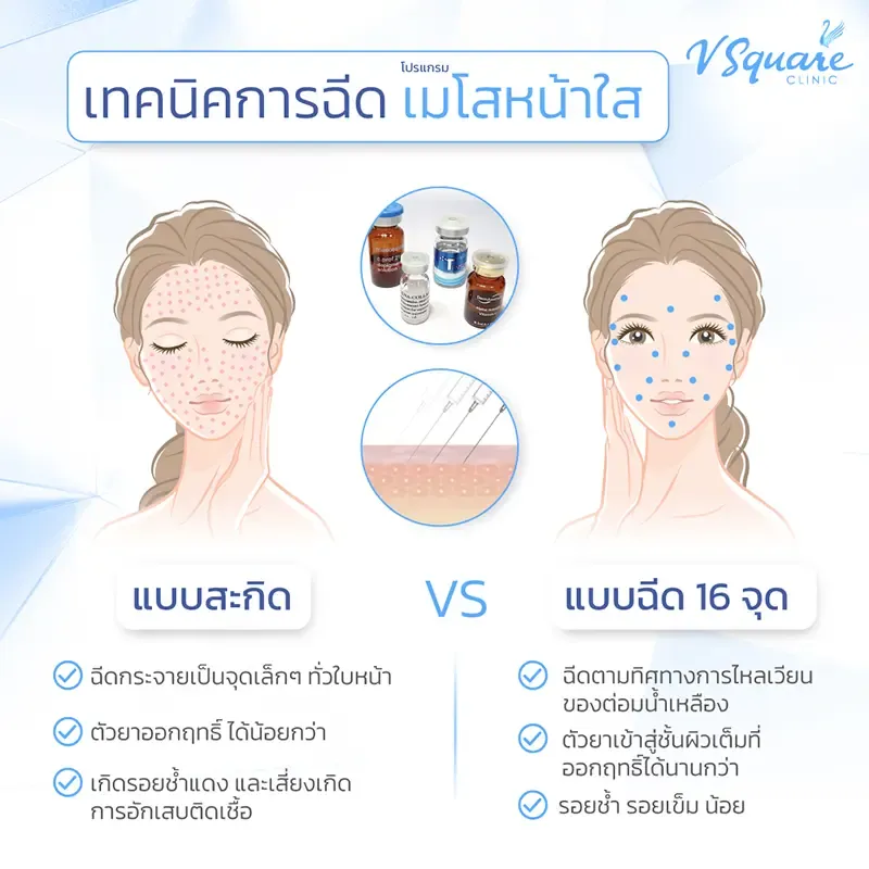 ฉีดเมโสหน้าใส 16 จุด vs สะกิดหน้าใส