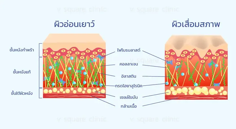 เมโสหน้าใสฟื้นฟูผิวอ่อนเยาว์