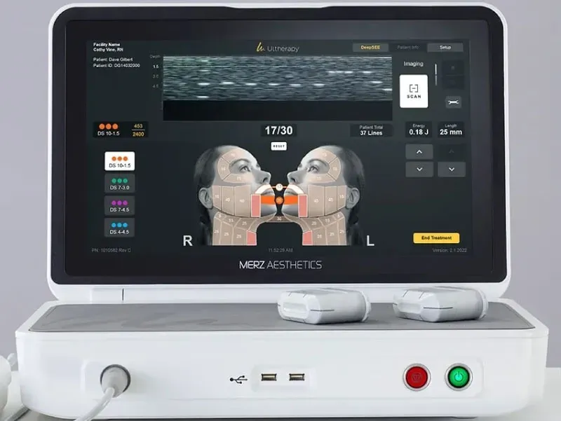 จอแสดงผล Ulthera Prime จอแสดงผล Ulthera Prime