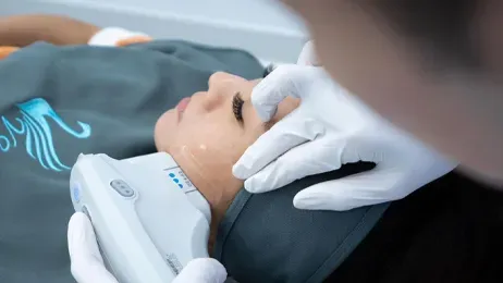 Ulthera SPT หัตถการยกกระชับผิว