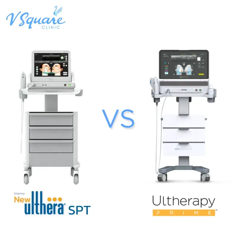 Ulthera SPT vs Ulthera Prime Ulthera SPT vs Ulthera Prime