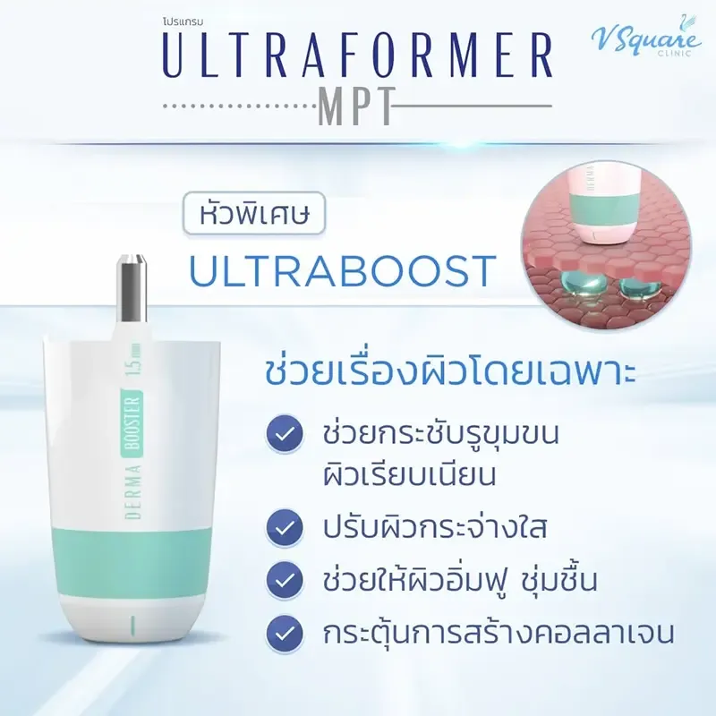 หัว Ultraformer MPT