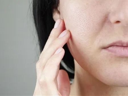 ร่องแก้มลึก