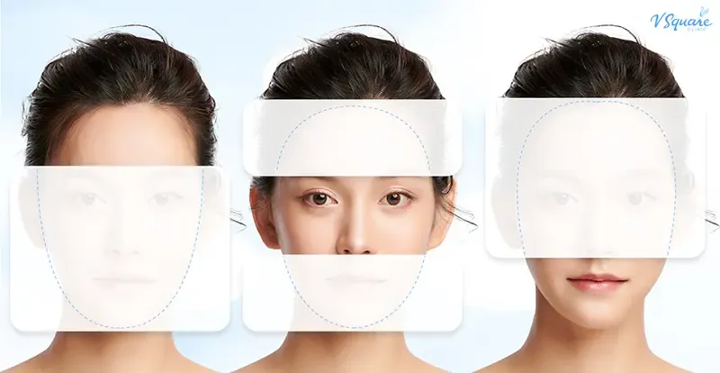 สัดส่วนใบหน้า