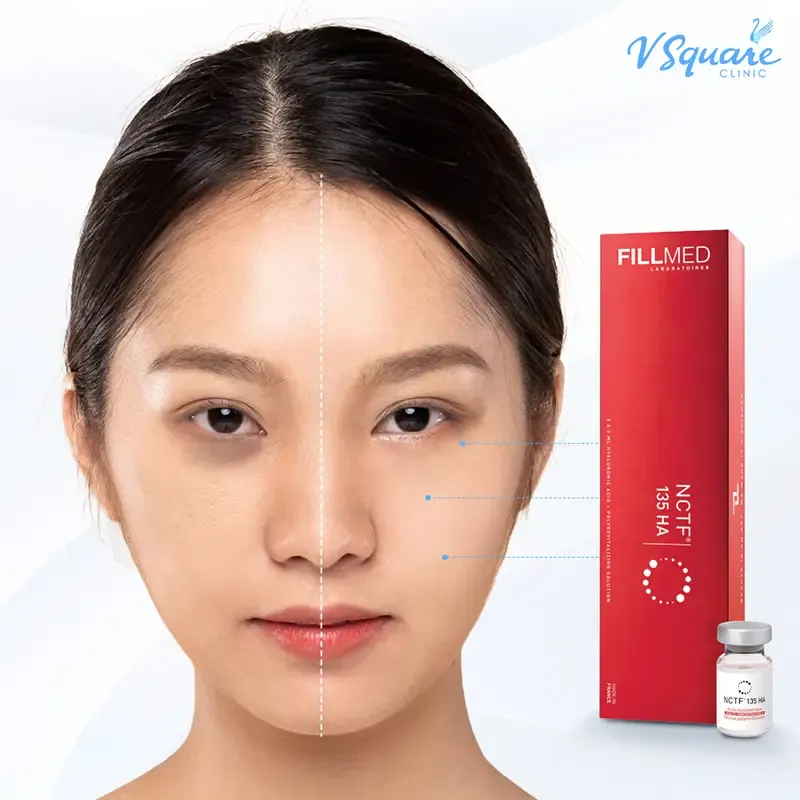 Filorga ใต้ตา