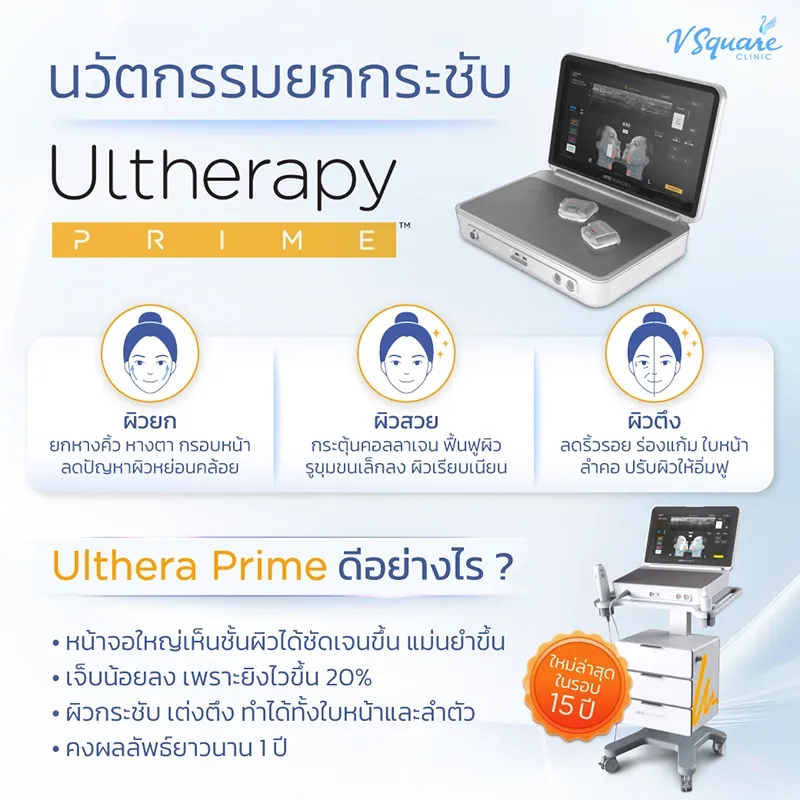 Ulthera Prime ดีอย่างไร