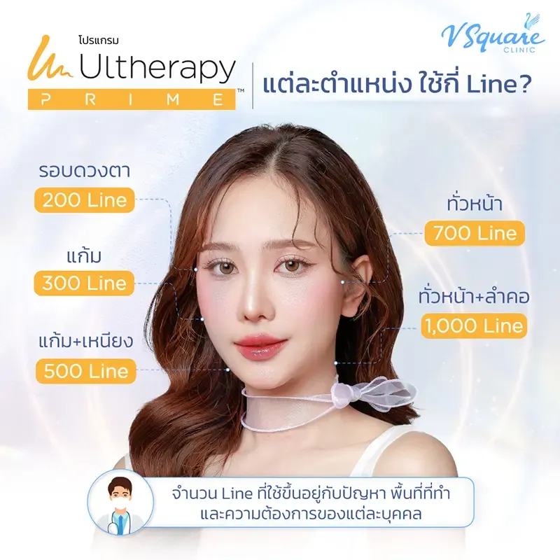 Ulthera ทั่วหน้า กี่ช็อต ไลน์