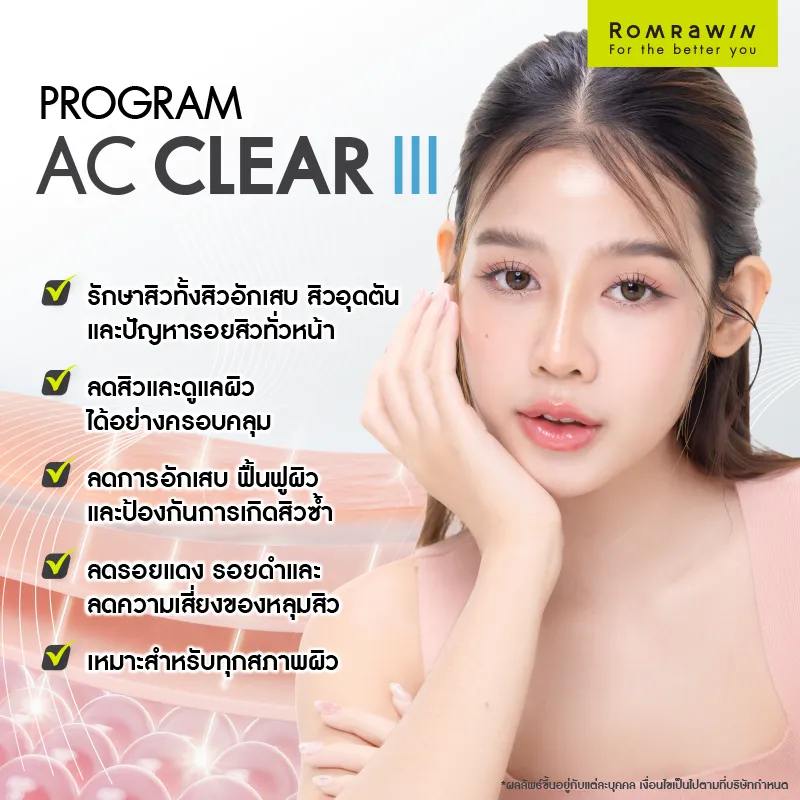 รักษาสิว