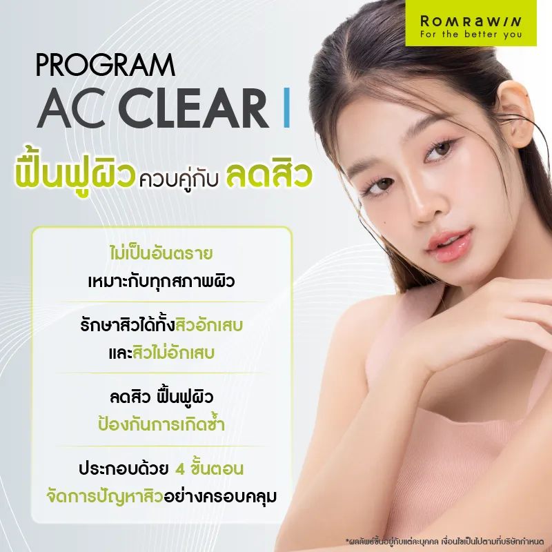 รักษาสิว