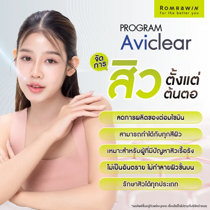 รักษาสิว