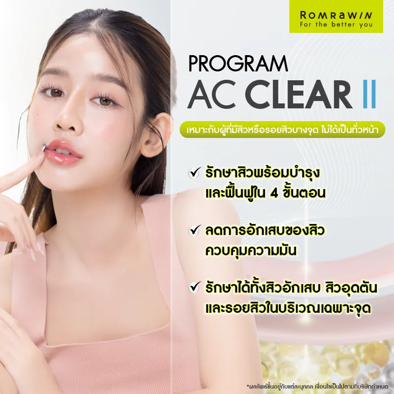 รักษาสิว