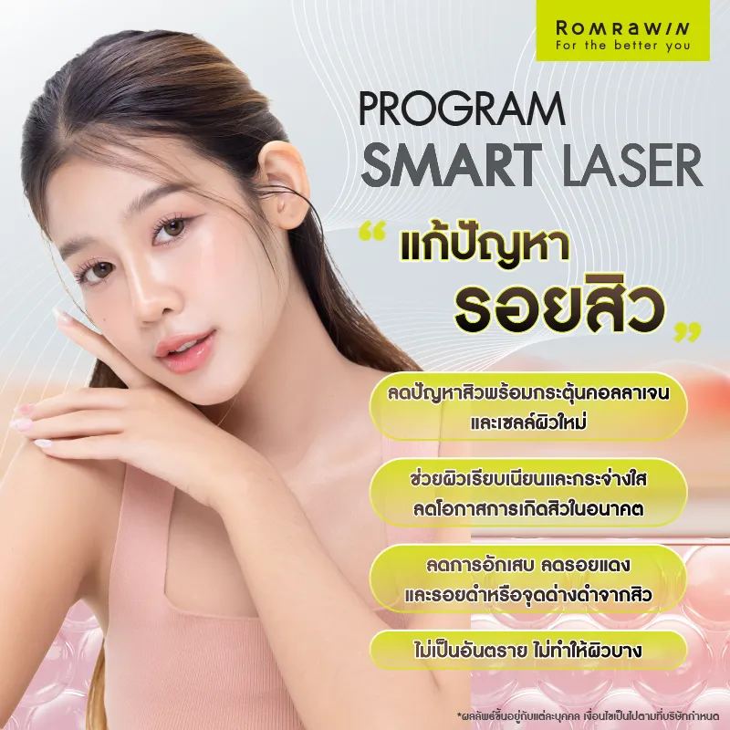 รักษาสิว