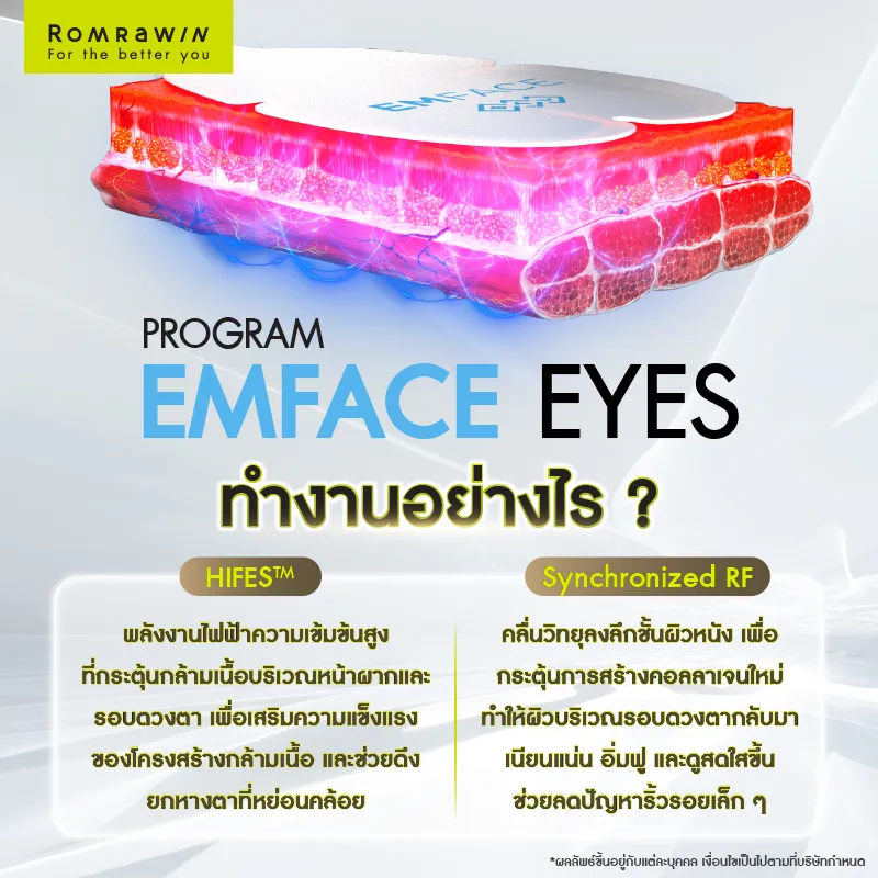 ยกกระชับรอบดวงตา