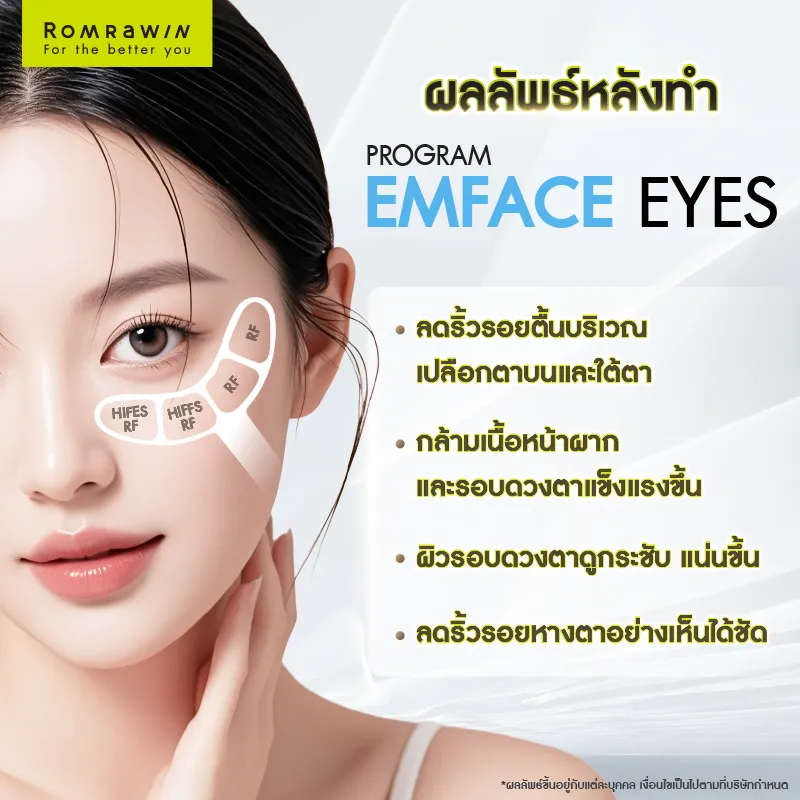 ยกกระชับรอบดวงตา